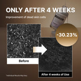 NIDA White Black Exfoliating Serum Duo Bundle