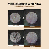 NIDA Baby Face Cleanser Bundle (Set of 4)