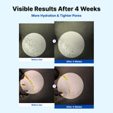 Crème hydratante ultime NIDA Youthful Formula™ 