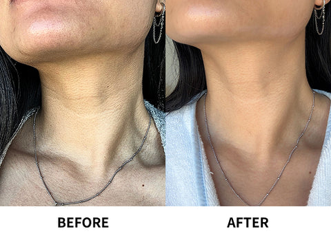 Before and After - Monika J.