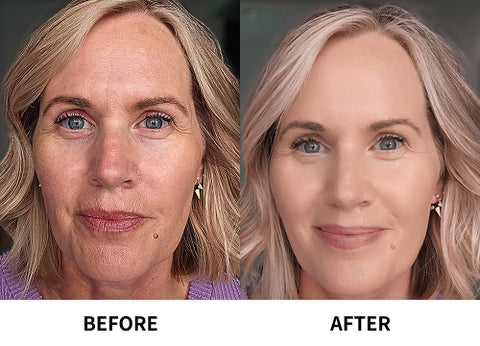 Before and After - Andrea B.